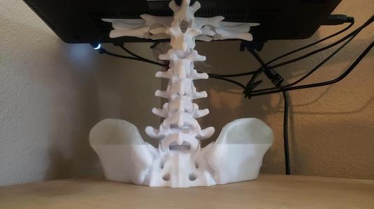 t11 mutant vertebrae shelf