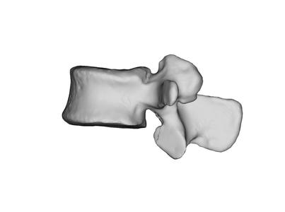 Vertebrae of lumbar spine - Wirbelkörper lumbal