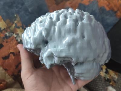 My spouses brain