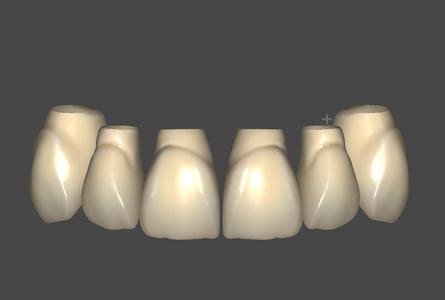 Anatomic exocad Library #6