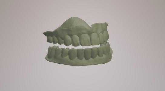 dentures