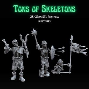 Tons of Skeletons: Equipped Skeletons Command Group
