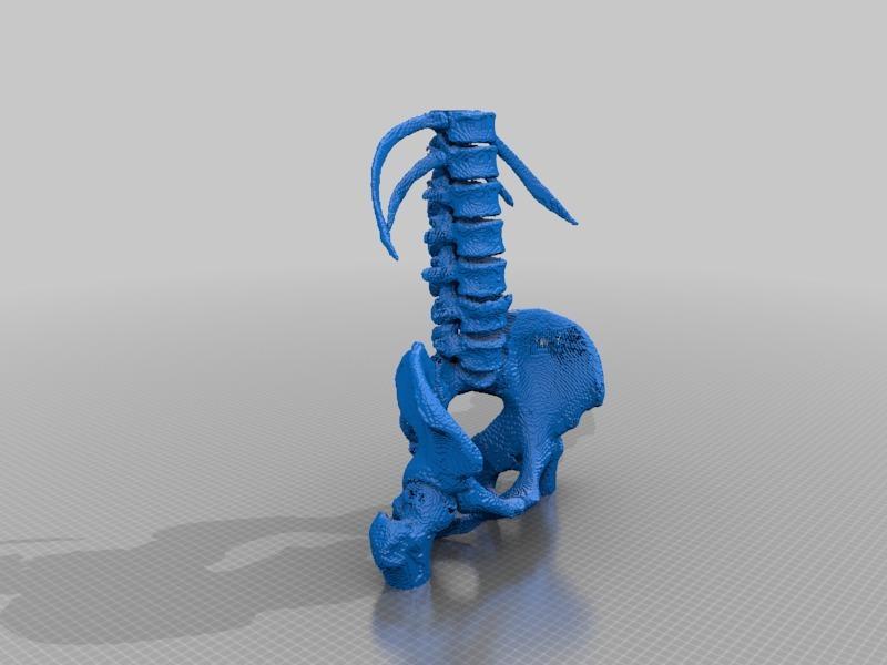 Lumbar Spine and Pelvis