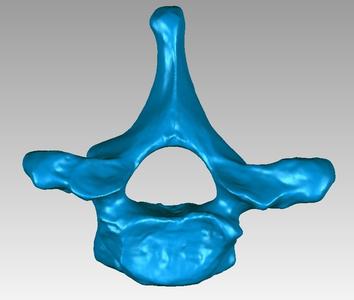 Thoracic vertebra of a human