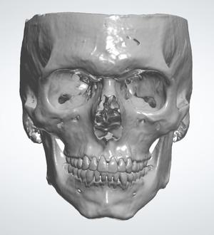 MAXILLARY MANDIBULAR SKULL BASE WITH COMPLETE BIMAXILLARY TEETH