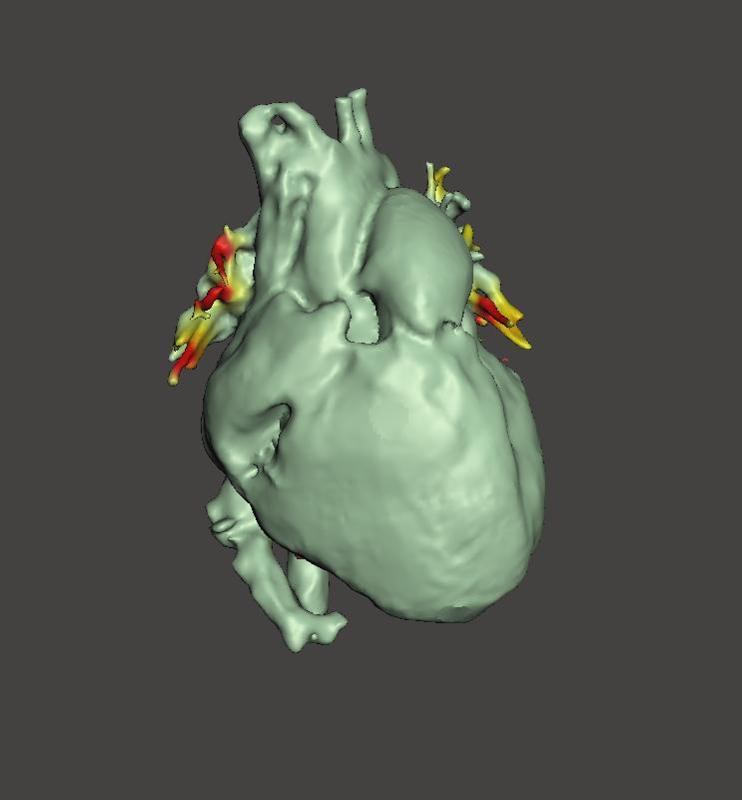 Human anatomical heart