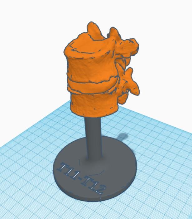T11-T12 SPINAL MODEL