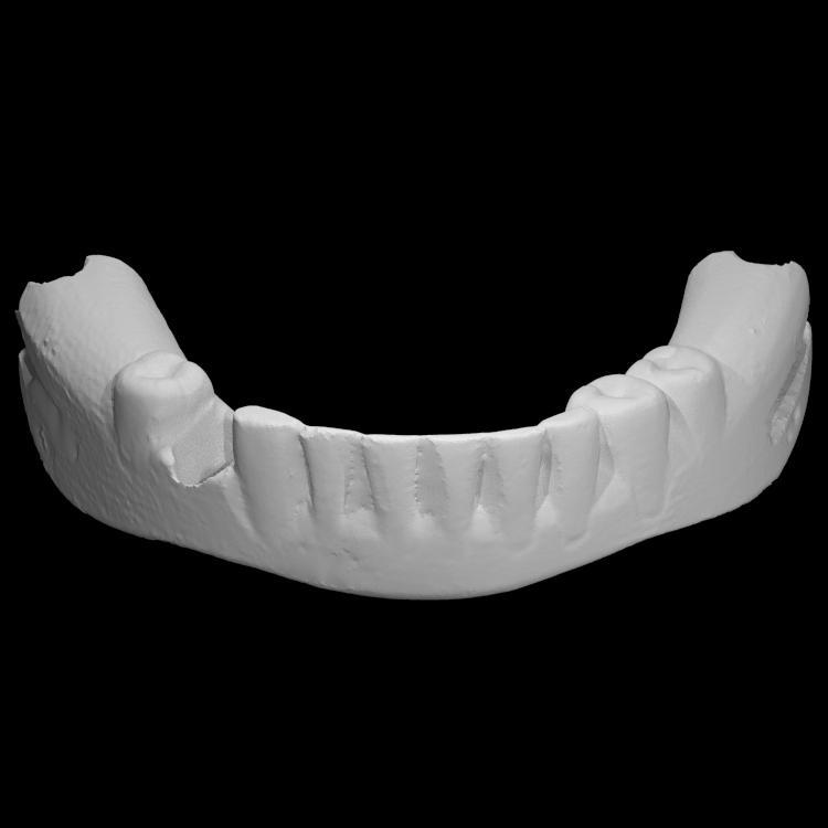 George Washington's False Teeth - Bottom Half