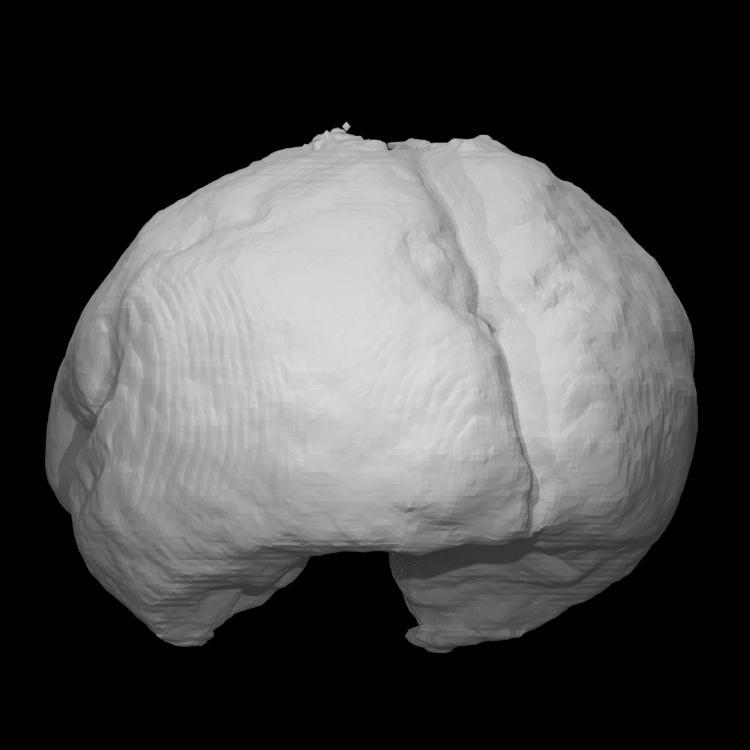 Foetus Brain