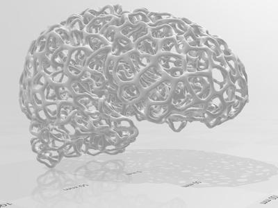 Voronoi Brain Scan