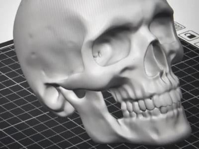 Skull