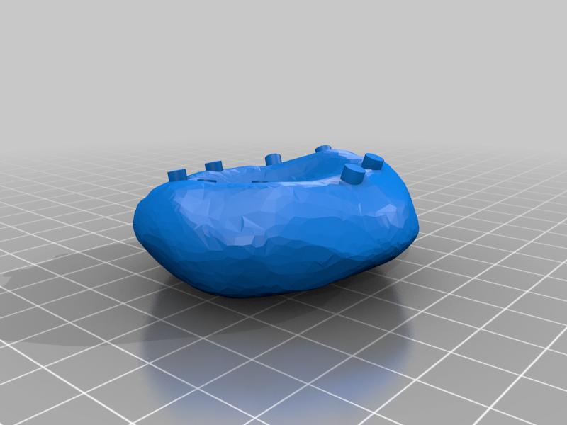 ABO blood group system (Sistema sanguíneo ABO)
