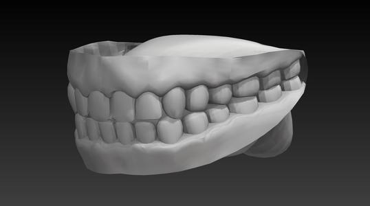 HUMAN TEETH