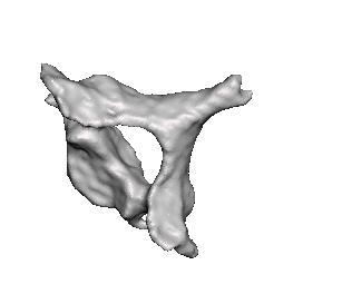 cervical spine - cervical spine