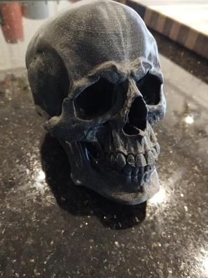 Skull with brace