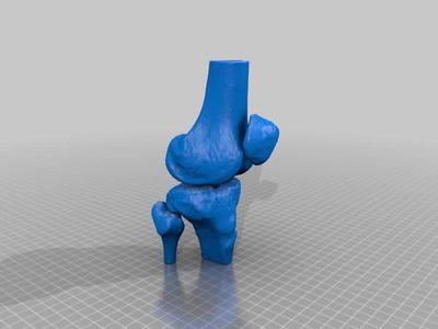 genou - scan 3D