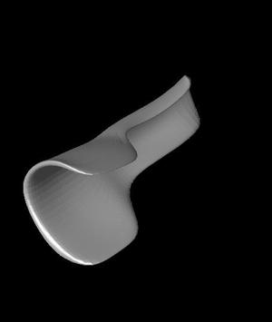 SplintR.stl