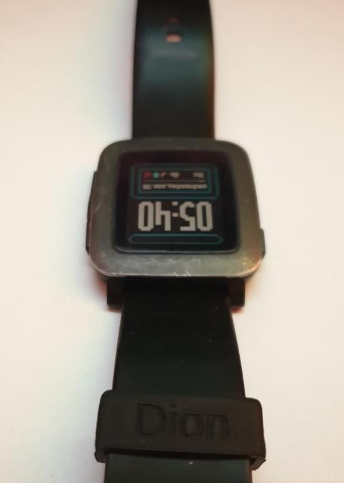 Customizable watch band fix (Pebble Time)