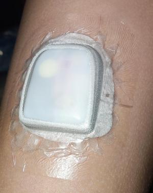 Omnipod insulin pump better adhesion kit