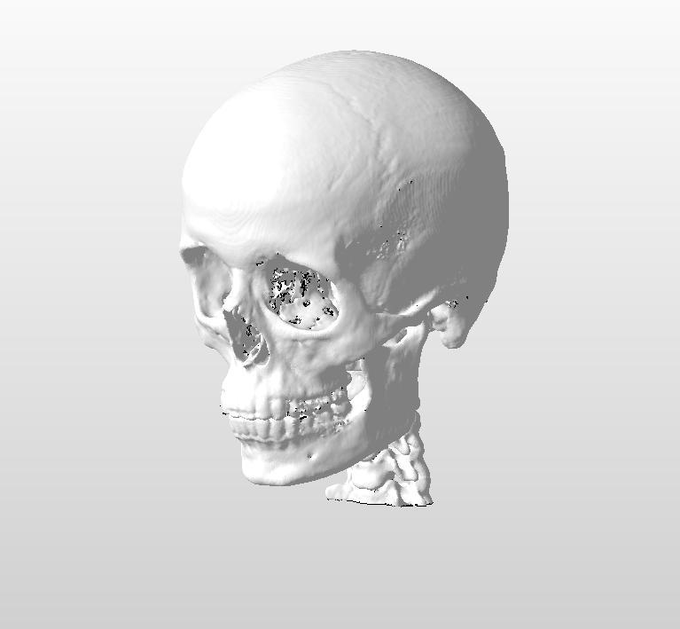 SKULL