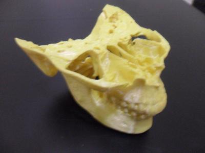 Skull base and jaw