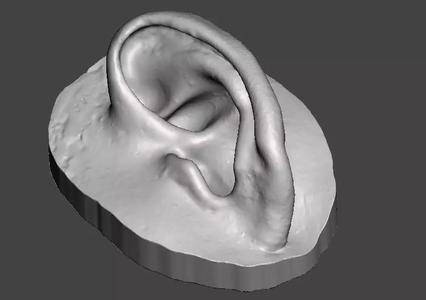 Natural ear anatomy left side