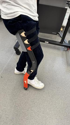 3D printed leg brace