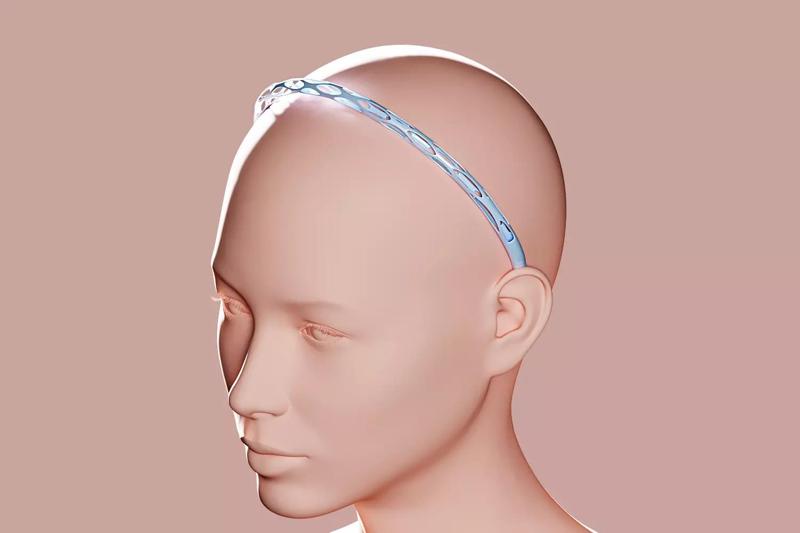 Voronoi Rim to style hair
