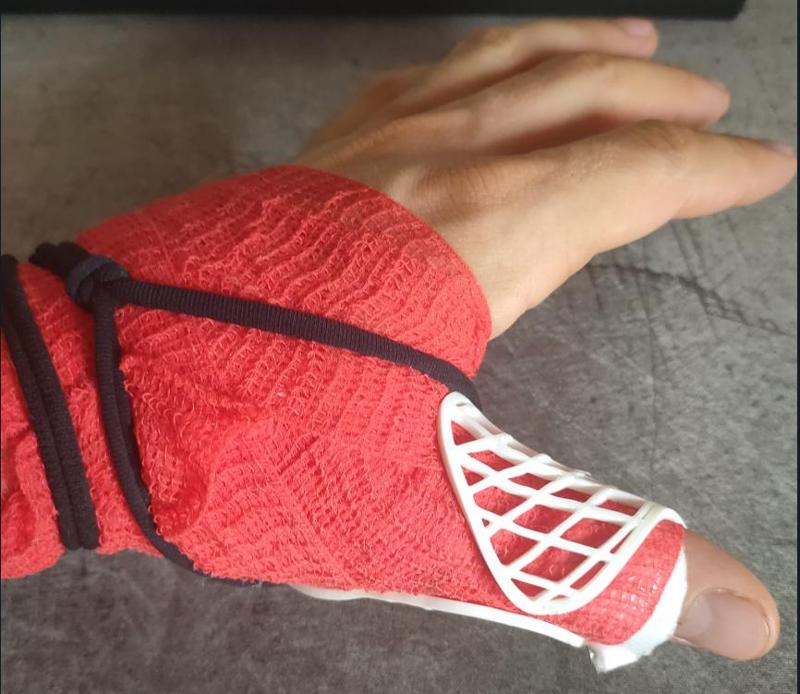 Thumb brace/splint - joint restrictor