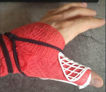 Thumb brace/splint - joint restrictor