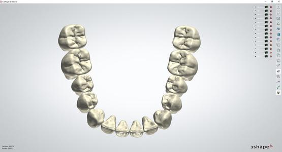 3Shape OPEN Library AP_Exo_triangular