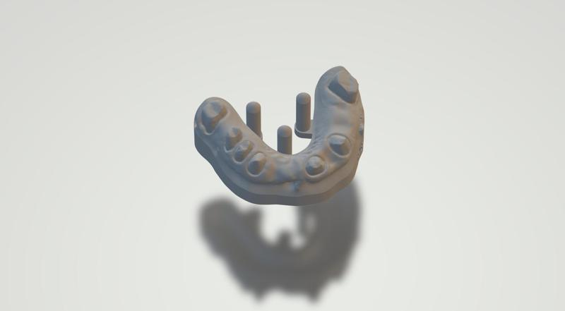 Dental project complete