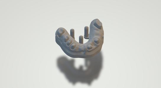 Dental project complete