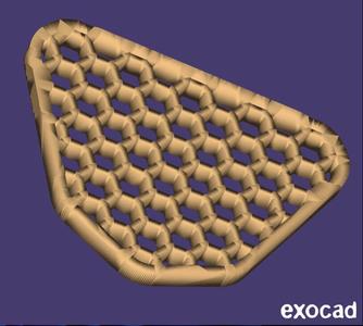 Exocad Dental Model Base – Decorative & Support-Free