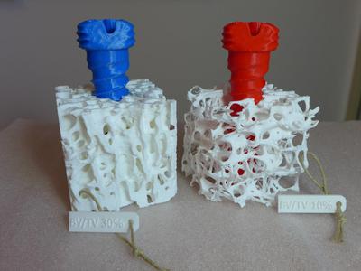 Trabecular bone osteoporosis model with bone screw