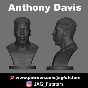 Anthony Davis - Lakers - Bust