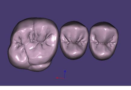 molares y premolares