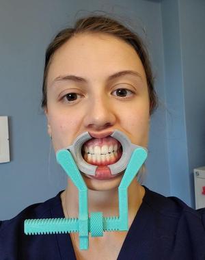 Microstomia Splint + Adjustments