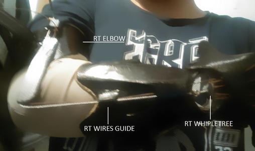 RT ELBOW (beta)