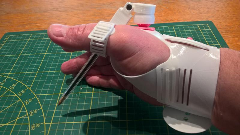 Evolution prothese de main ( droite )