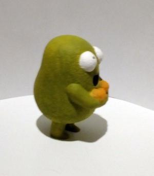 Gallbladder and Stones