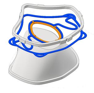 Thermoformed Filter support frame