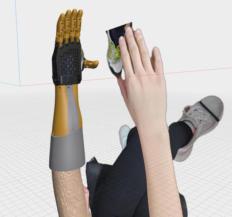 Mid-height arm prosthesis
