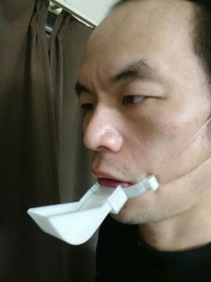shovel jaw