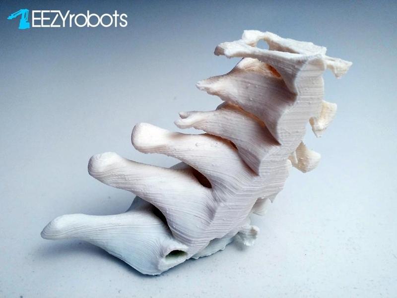 3D printed Cervical Spine