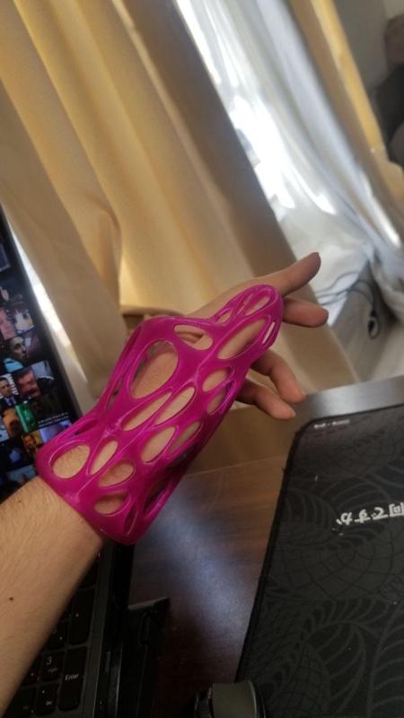 Custom-Fit Thumb Protector