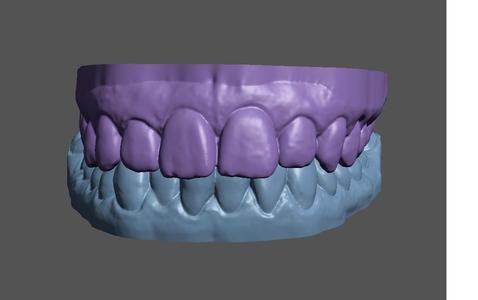 2 real teeth dental 3d models - 01