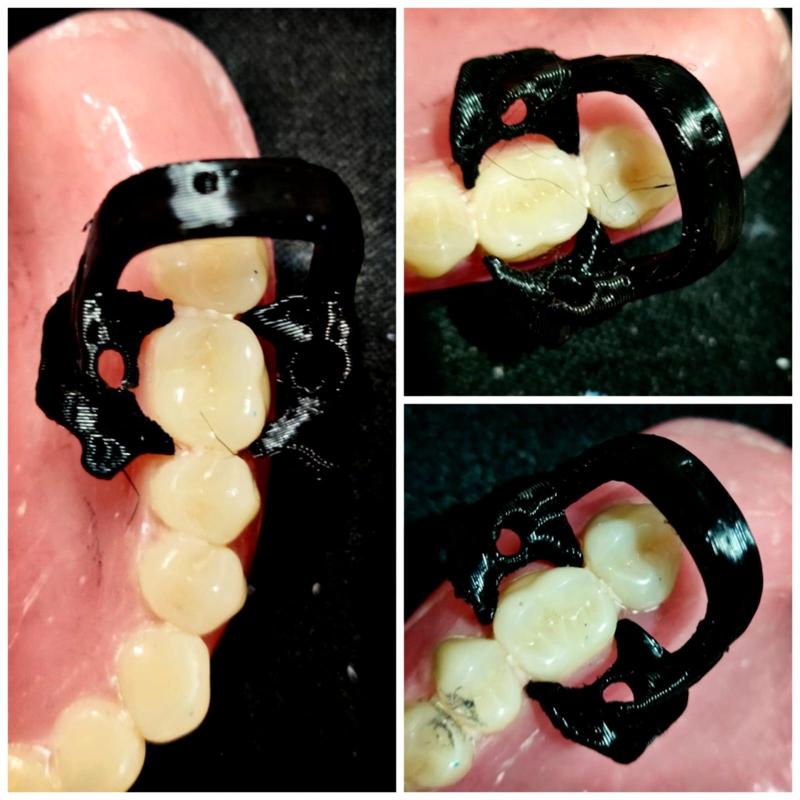 dental clamp
