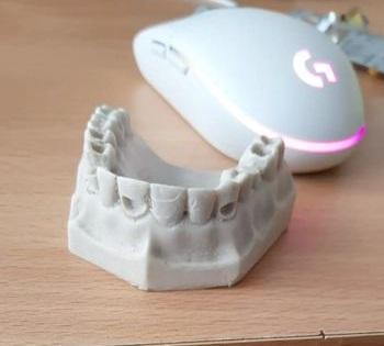 Upper Denture Practicals - Dentistry