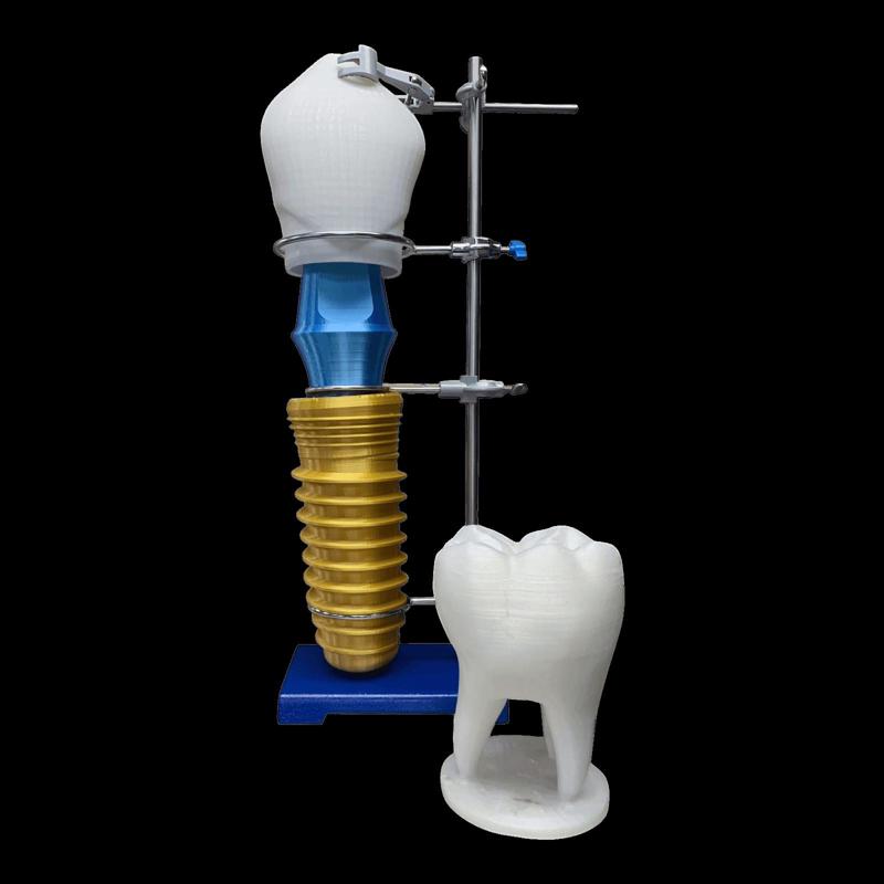 🦷 Dental Implant Demonstration Model – 3D Print Ready